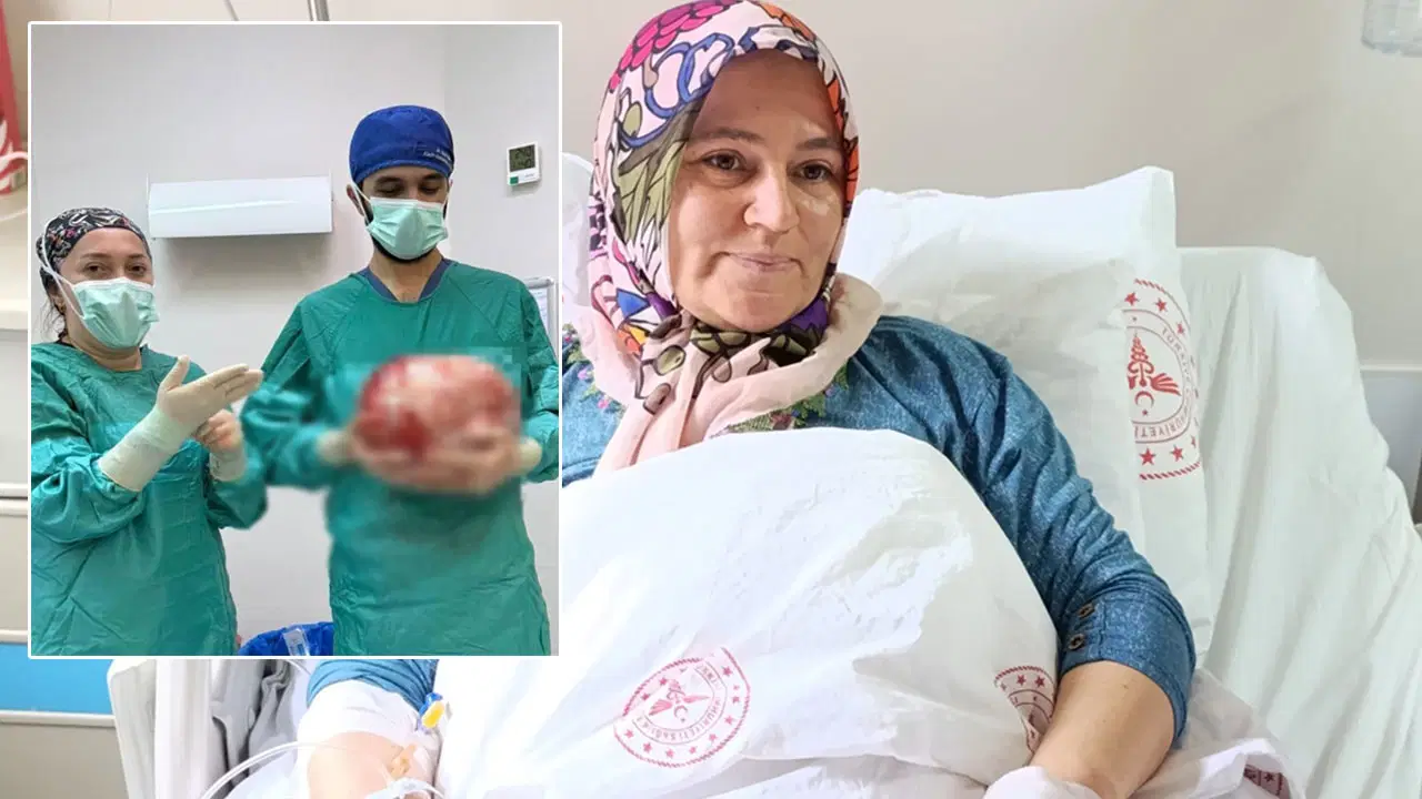 Karın ağrısıyla hastaneye gitti: 8,5 kiloluk kitle çıkarıldı!